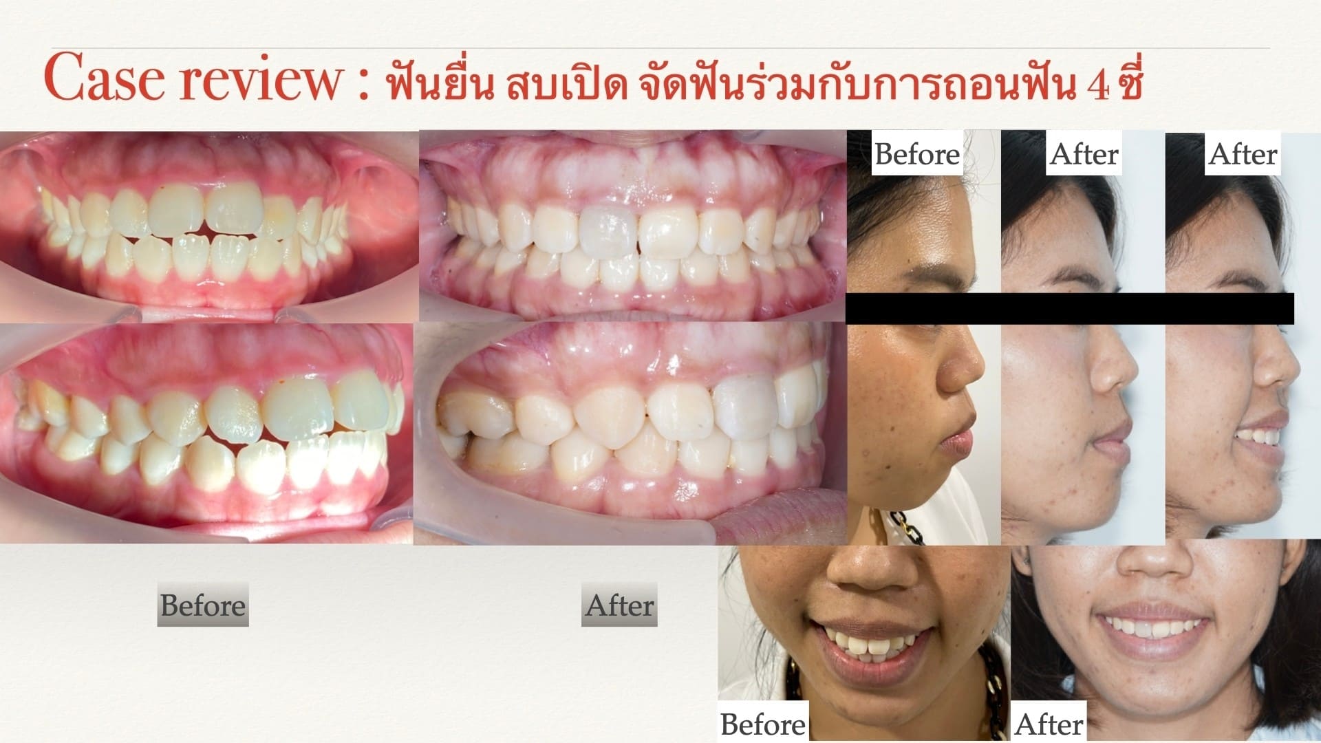 Review-2
