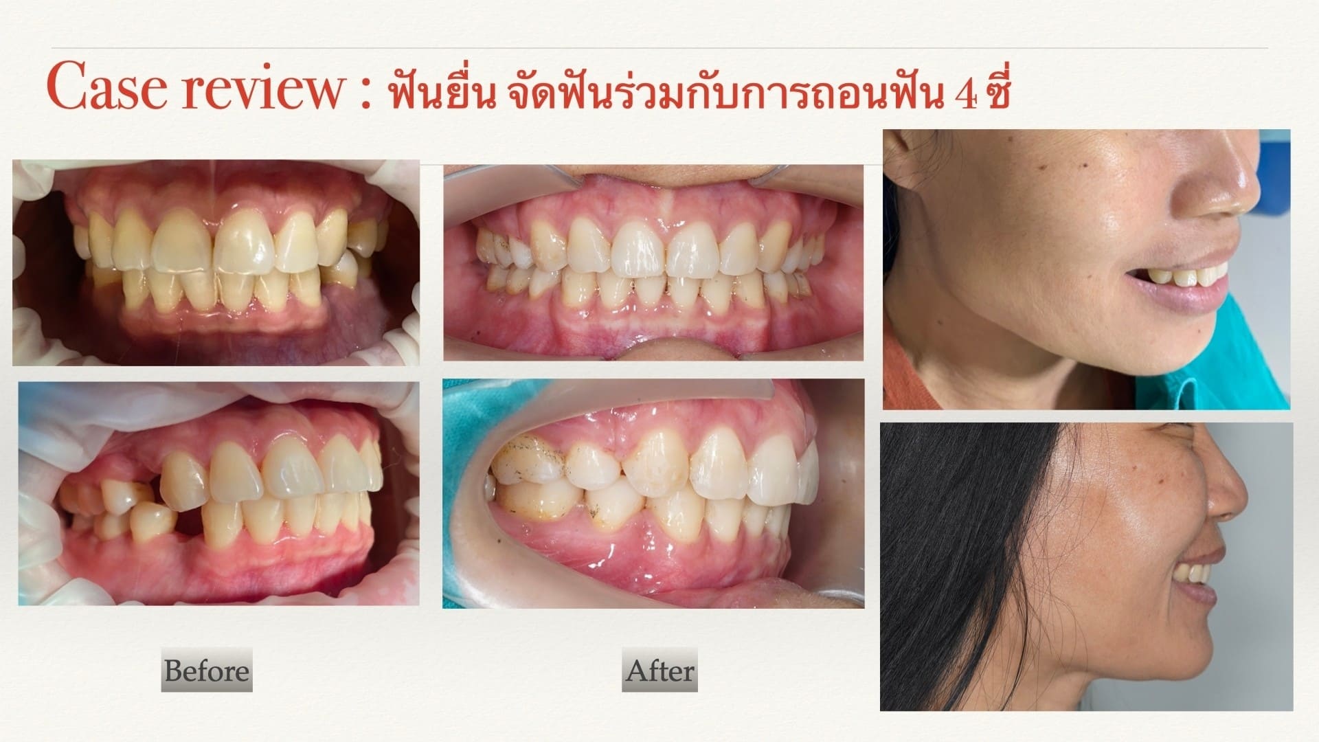 Review-4