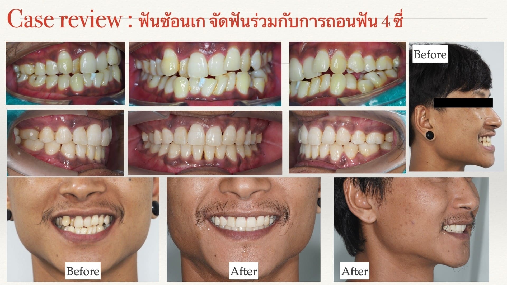 Review-5