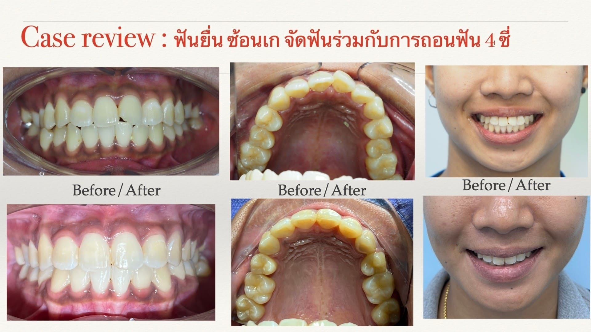 Review-6